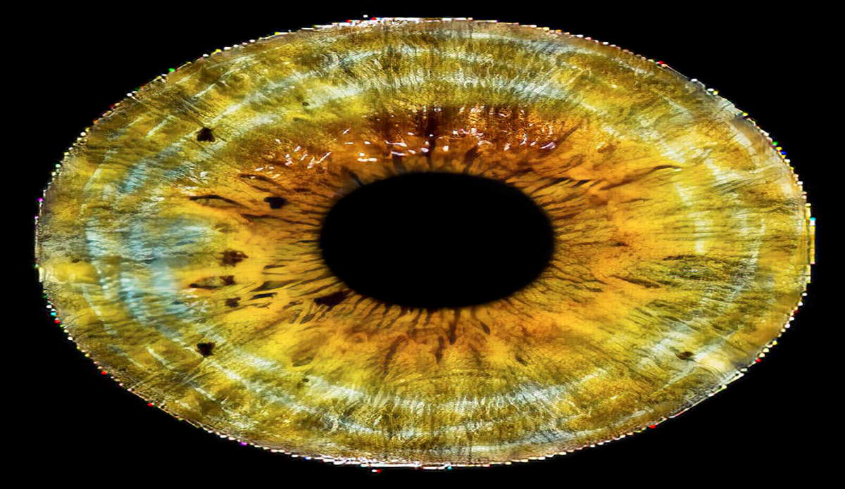 eye image